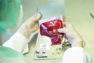 torba z krwią trzymana przez lekarza
