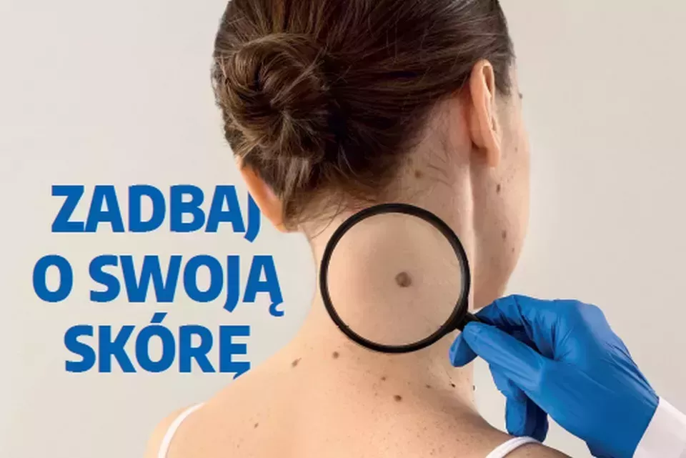 Bezpłatne badanie skóry już 1 sierpnia w Koszęcinie